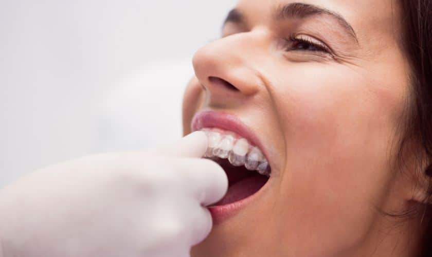 Invisalign in Round Rock