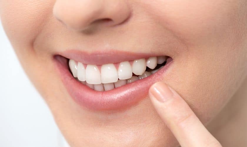 teeth whitening
