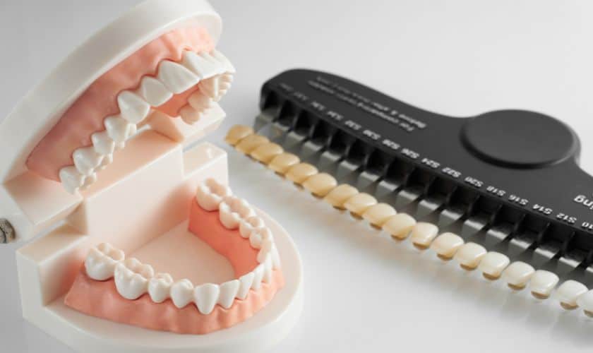 Teeth Whitening