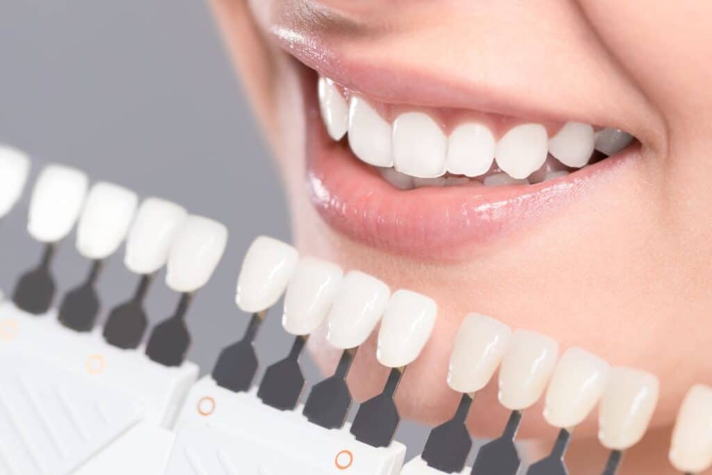 Teeth Whitening in Round Rock, TX