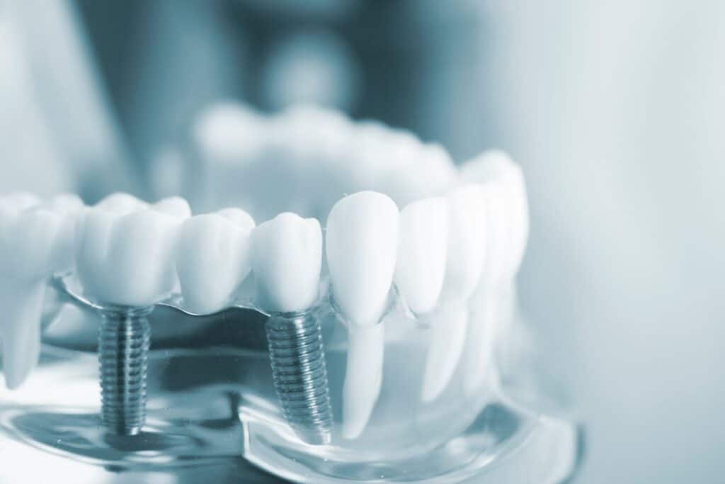 Cosmetic Dentistry In Round Rock