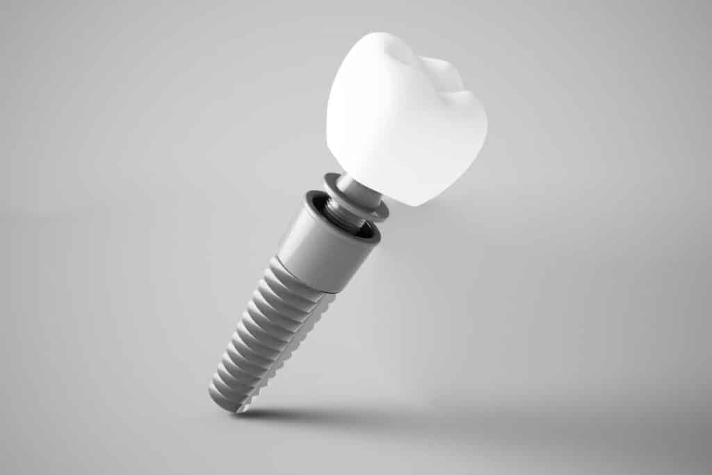 Dental Implants in Round Rock