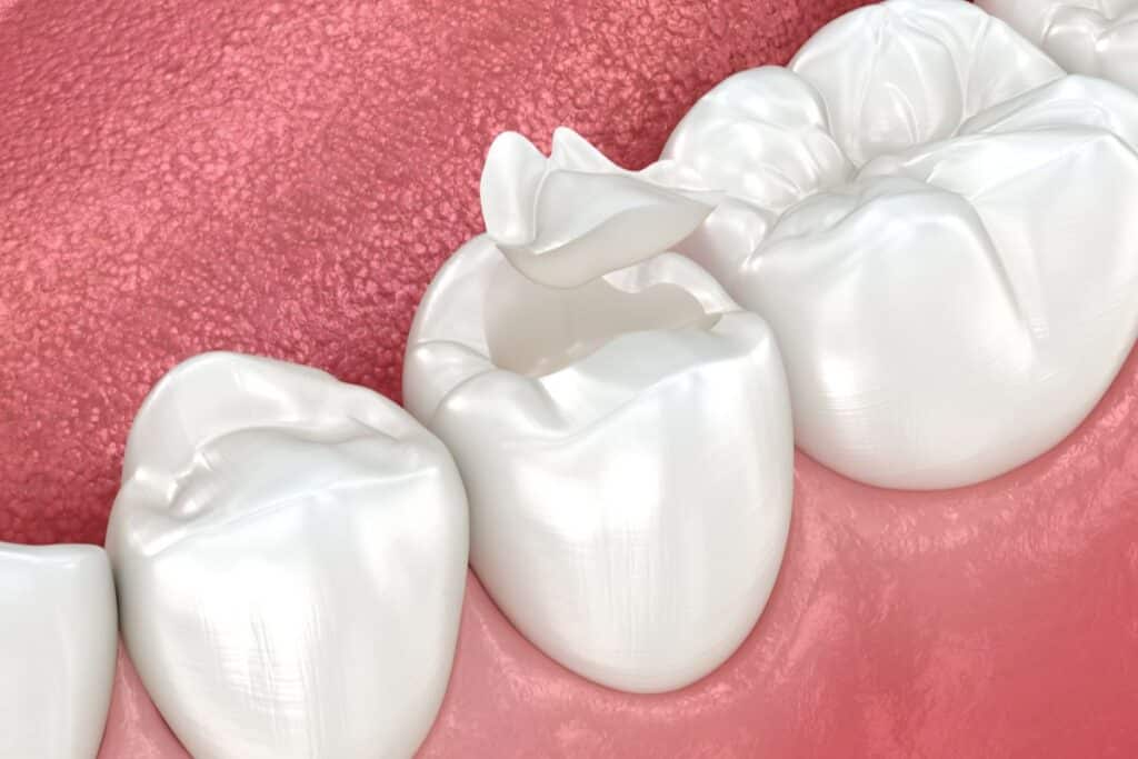 Dentist in Round Rock