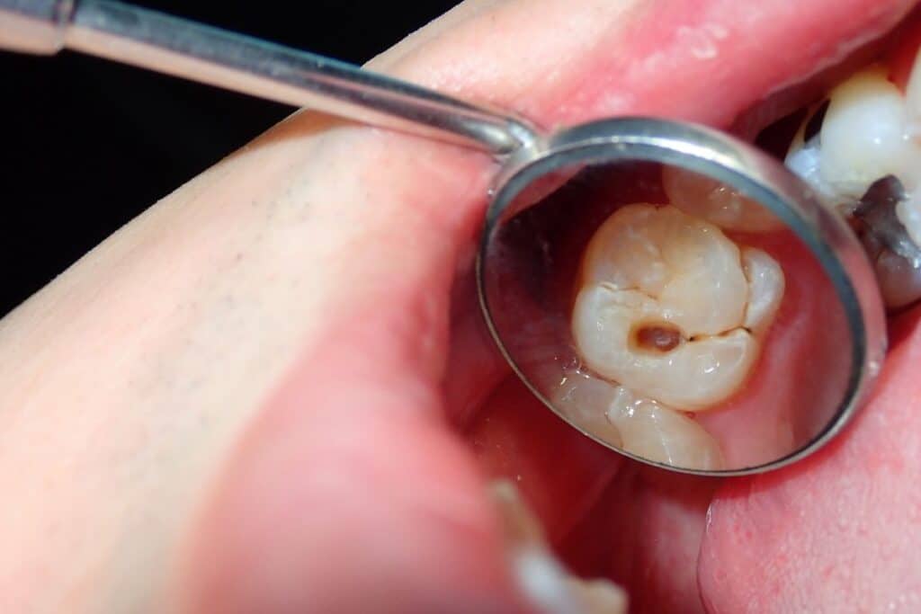 General Dentistry in Round Rock