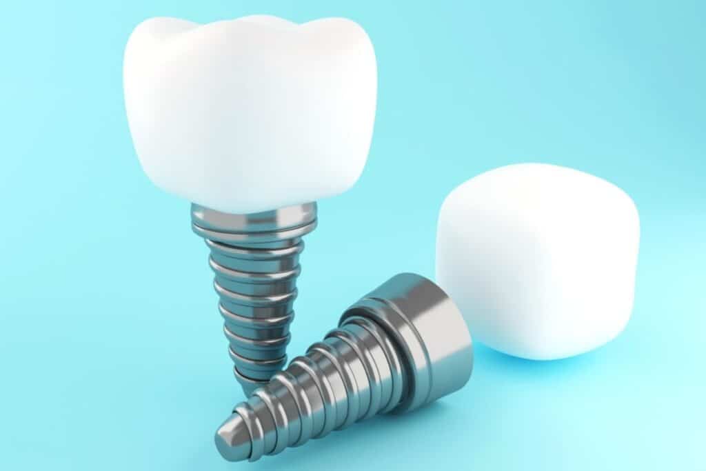 Dental Implants in Round Rock