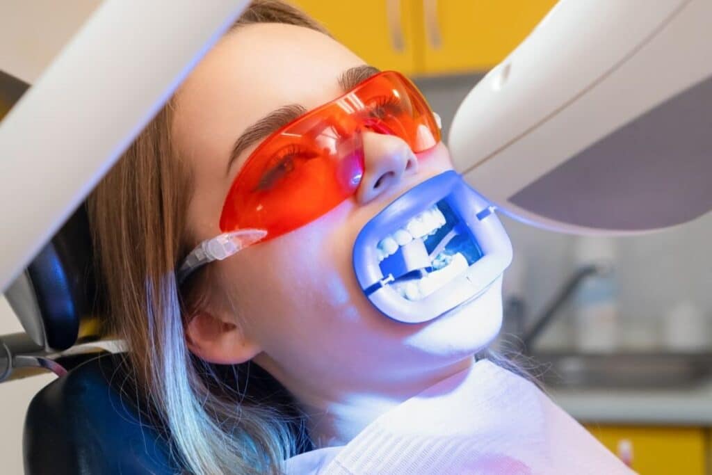 Get a Brighter Smile Before the 4th of July