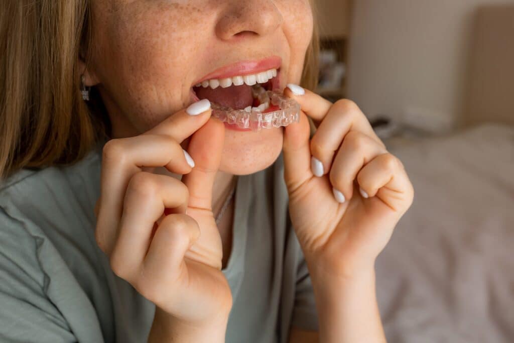 closeup of a young woman placing her clear aligners in mouth